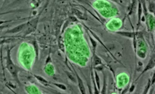 Celule stem, Foto: PhotoExpress