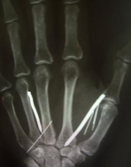 Dovada torturii, Foto: Reuters