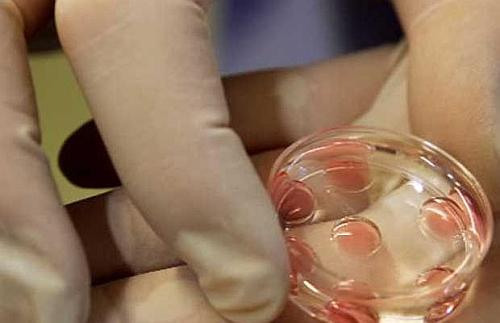 Fertilizare in vitro FIV, Foto: Reuters