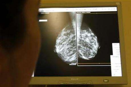 Mamografie, Foto: Reuters