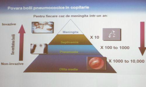 Povara bolii pneumococice in copilarie, Foto: MedLive.ro