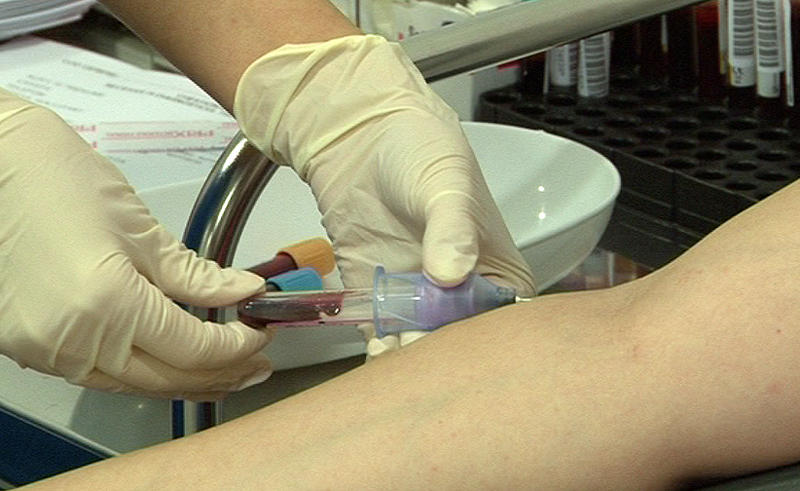 Liste de asteptare pentru bolnavii de SIDA, Foto: MedLive.ro