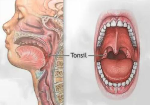 Amigdalele au rol in apararea locala si generala a organismului , Foto: Captura Youtube.com