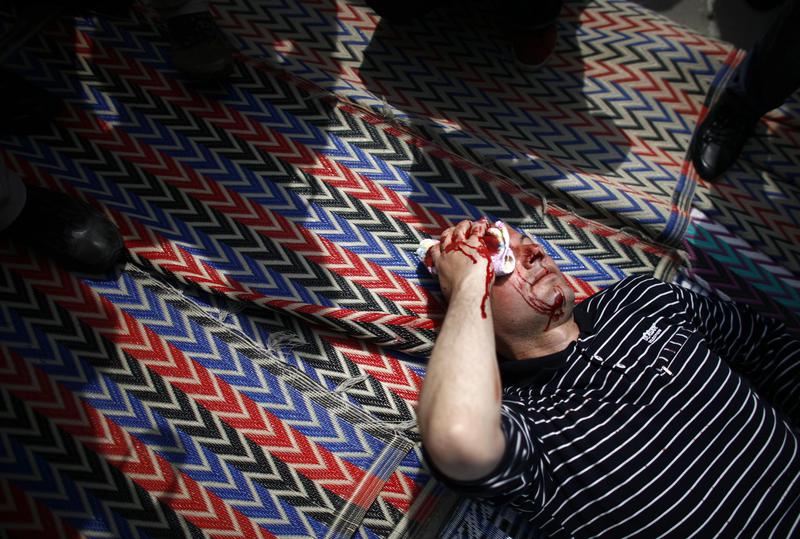 Musulman ranit, in urma atacului nationalistilor, Foto: Reuters