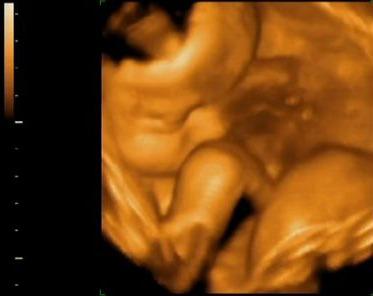 Drepturile copilului nenascut, Foto: Captura Vimeo.com