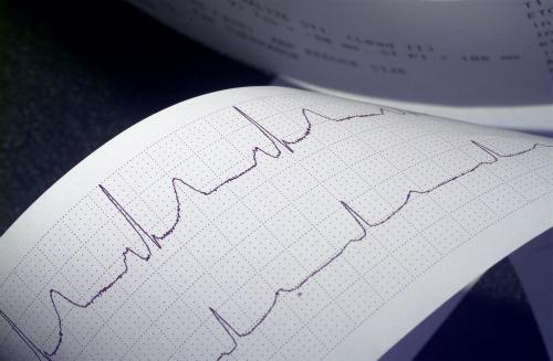 EKG, Foto: Captura YouTube