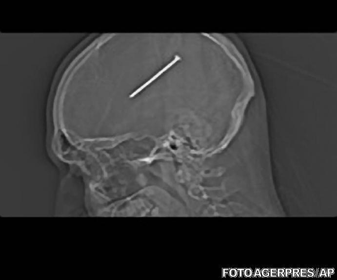 Barbatul se reface dupa operatie, Foto: Agerpres