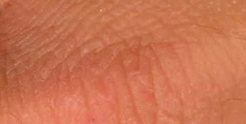 Piele uscata, Foto: MorgueFile.com