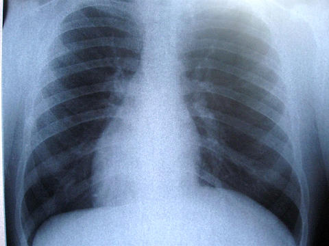 Radiografie, Foto: MorgueFile.com