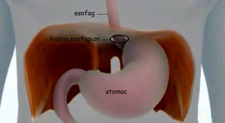 Pasajul transhiatal al esofagului, Foto: MedLife