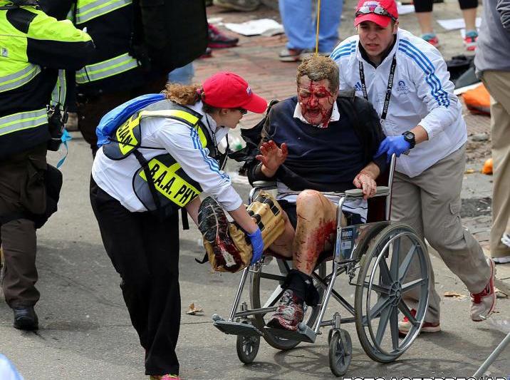 Un barbat cu piciorul sfartecat de explozie - Boston, Foto: Agerpres/AP