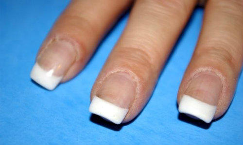 Unghiile albe, un semn al hepatitei, Foto: MorgueFile.com