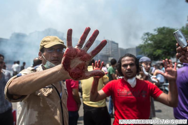 Manifestanti in Cairo isi arata mainile pline de sange, dupa interventia fortelor de ordine, Foto: Agerpres/Xinhua