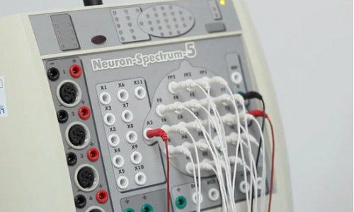 Electroencefalograf, Foto: MedLive.ro