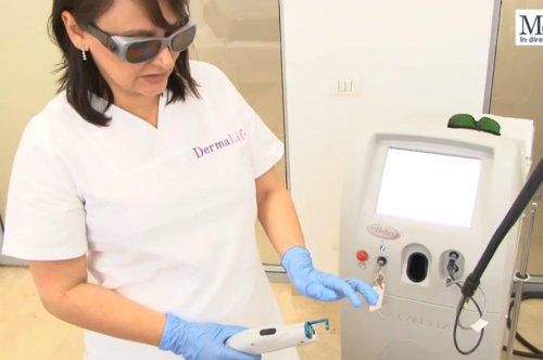 Laserul Vbeam, Foto: MedLive.ro