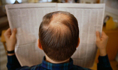 Alopecia nu semnaleaza o problema medicala serioasa, Foto: Captura Vimeo.com