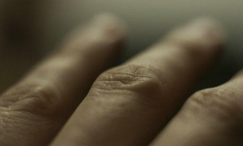 Durerile articulare, primul semn al lupusului, Foto: MorgueFile.com