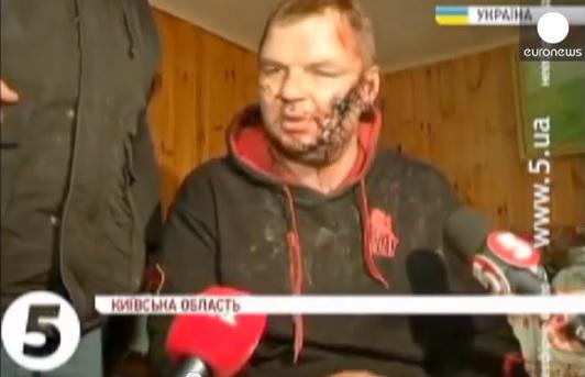Dmytro Bulatov, militant ucrainean torturat, Foto: Captura YouTube