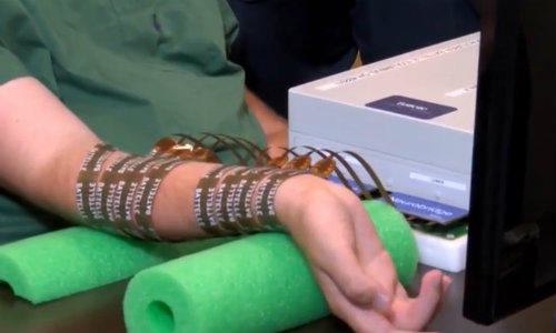 Neurobridge, dispozitivul care transmite semnale de la creier la muschi, Foto: Captura YouTube
