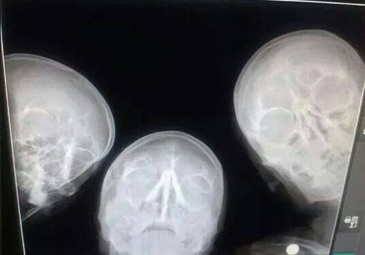 selfie de radiologi, Foto: Hotnews