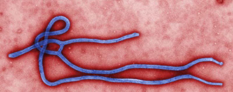 virusul Ebola, Foto: Centers for Disease Control and Prevention