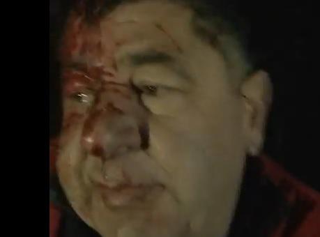 Mircia Muntean, scos din boscheti dupa accidentul din 2014, Foto: Captura YouTube