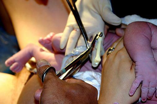 Taierea cordonului ombilical, spital in NY SUA, Foto: Ioana Marinache