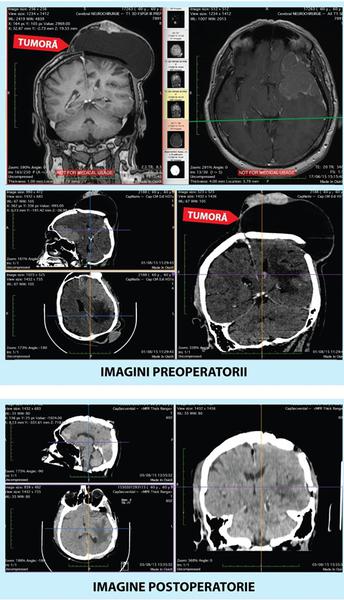 Imagini pre si postoperatorii , Foto: MedLife