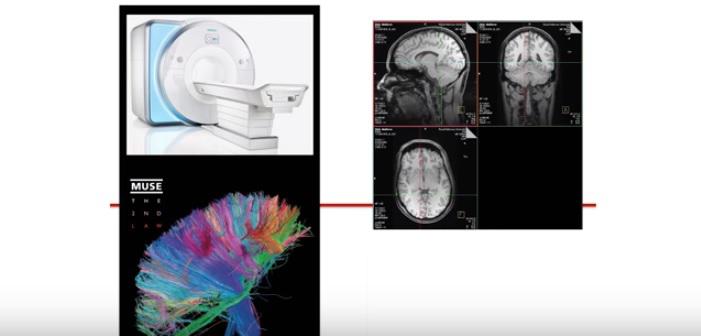 Imagistica prin fMRI si citirea gandurilor, Foto: Captura YouTube