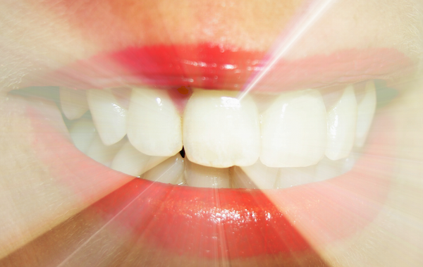 Zambet luminos, Foto: MorgueFile.com