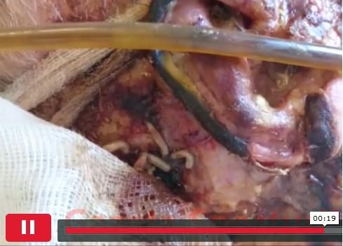 Pacient mancat de viermi, Foto: Gazeta Sporturilor