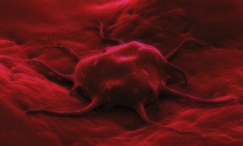Celula canceroasa, Foto: MedLive.ro