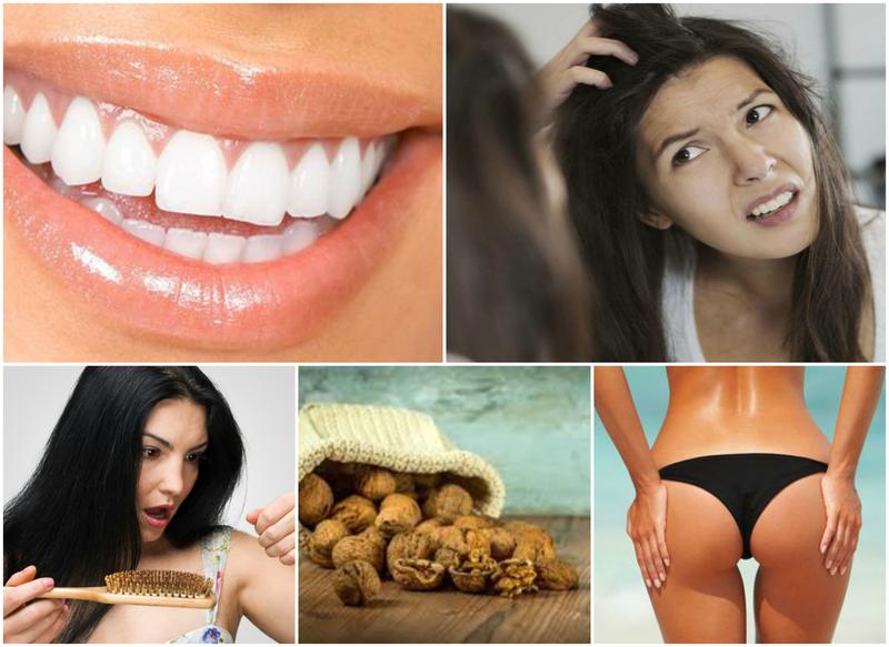 Utile, Foto: Colaj foto