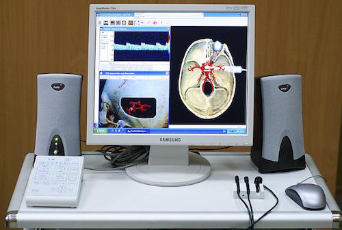 Ecografia Doppler a arterelor cervicale, Foto: Wikipedia