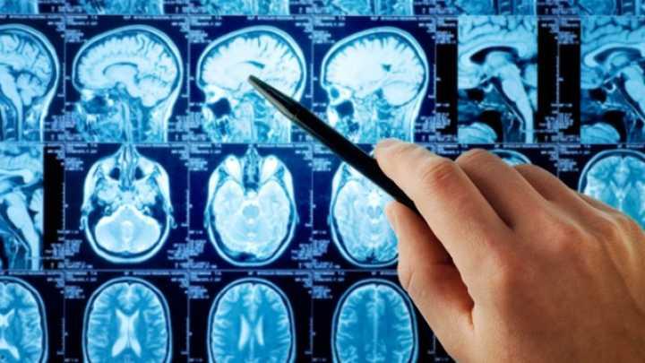 Nivelul ridicat de inflamatie in creier si aparitia gandurilor suicidale, Foto: Google