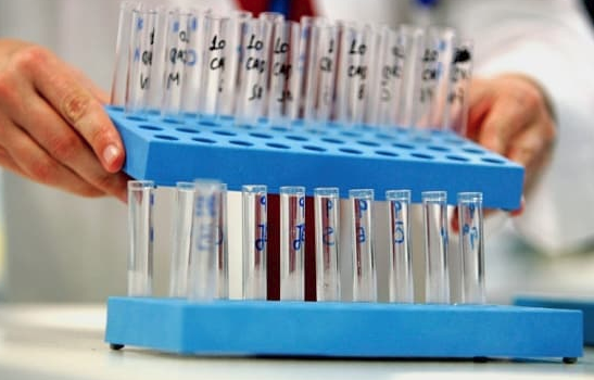 Control antidoping, Foto: wada-ama.org