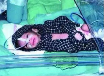 Fetița a stat ingropata 48 de ore, Foto: Times of India