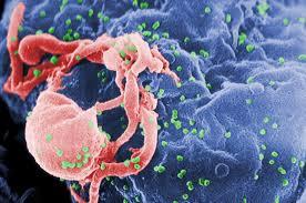 HIV, Foto: Wikipedia