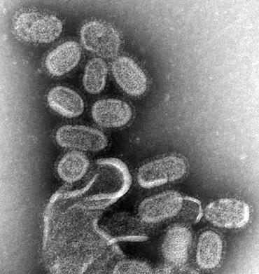 Virusul gripei, marit de 100.000 de ori, Foto: Wikipedia