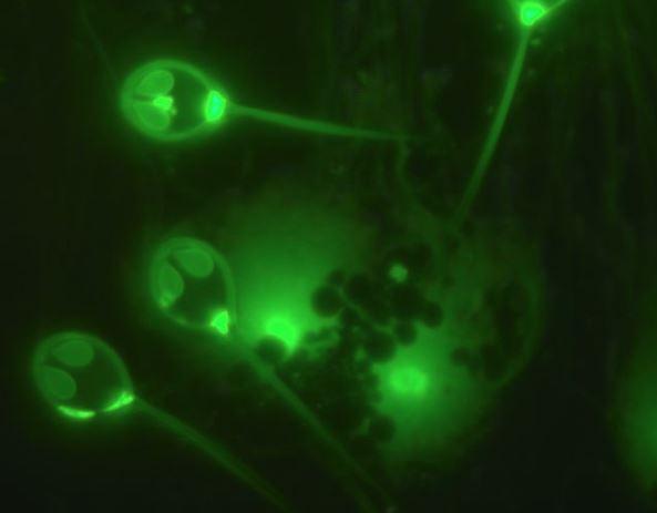 Henneguya salminicola, Foto: livescience.com