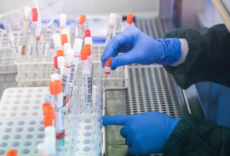 Testare coronavirus in laborator, Foto: Profimedia Images