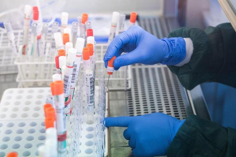 Testare coronavirus in laborator, Foto: Profimedia Images