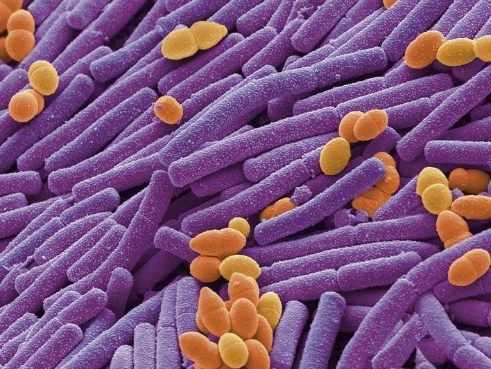 Bacterii, Foto: Science Photo Library / Sciencephoto / Profimedia