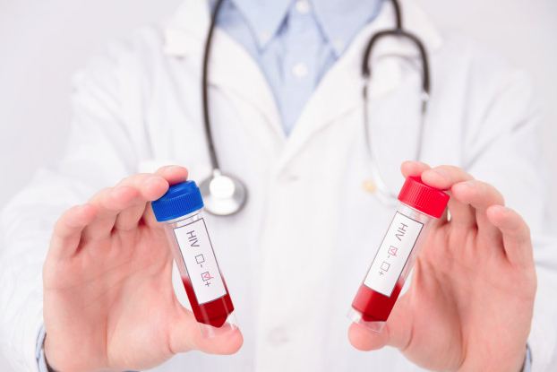 HIV, Foto: Freepik.com