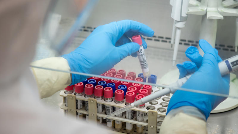 Testare RT-PCR , Foto: Hotnews