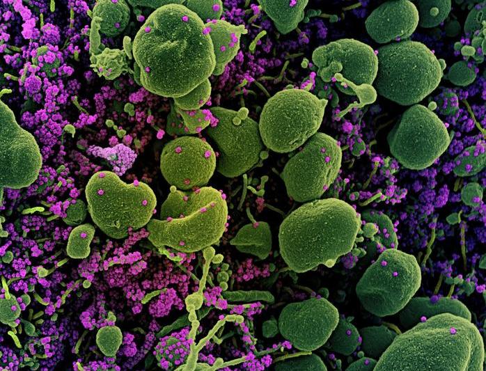 Celule infestate cu particule de coronavirus, Foto: Handout / AFP / Profimedia