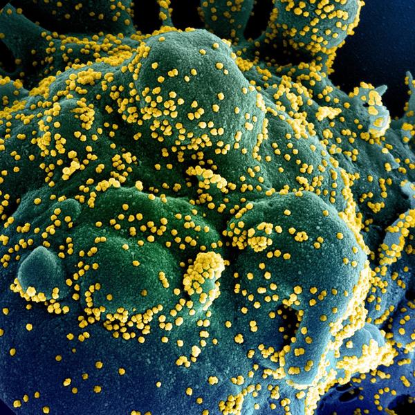 Particule de coronavirus (cu galben), Foto: Handout / AFP / Profimedia