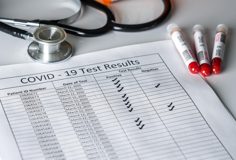 Teste anticorpi , Foto: MedLife