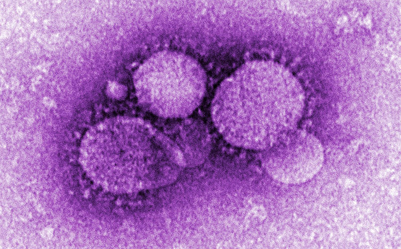 Coronavirusul MERS-CoV, Foto: CDC / BSIP / Profimedia Images