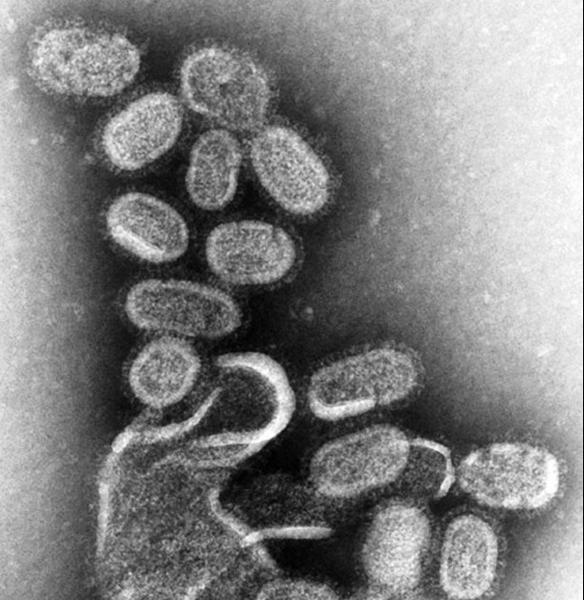 Virusul gripei mărit de 100.000 de ori, Foto: Wikipedia